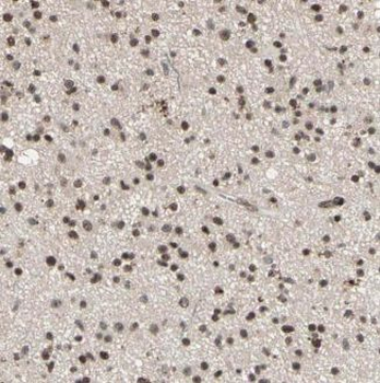 KHDRBS3 Rabbit Polyclonal Antibody