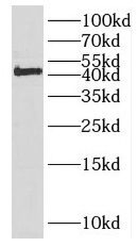 EFCAB14 Rabbit Polyclonal Antibody
