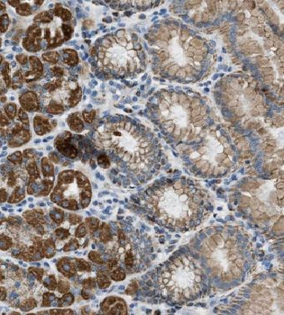 EFCAB14 Rabbit Polyclonal Antibody