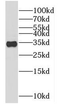 KIAA0513 Rabbit Polyclonal Antibody