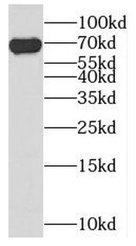 KHDC4 Rabbit Polyclonal Antibody