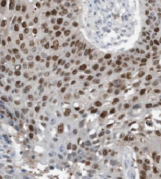 KHDC4 Rabbit Polyclonal Antibody