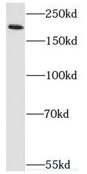 VIRMA Rabbit Polyclonal Antibody