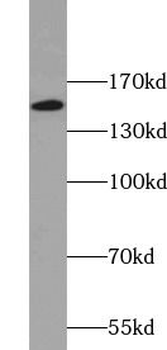 KIF15 Rabbit Polyclonal Antibody