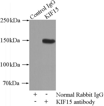 KIF15 Rabbit Polyclonal Antibody