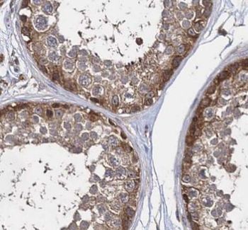 KIF15 Rabbit Polyclonal Antibody