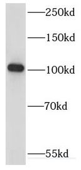 KIF18A Rabbit Polyclonal Antibody