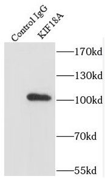 KIF18A Rabbit Polyclonal Antibody
