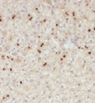 KIF18A Rabbit Polyclonal Antibody