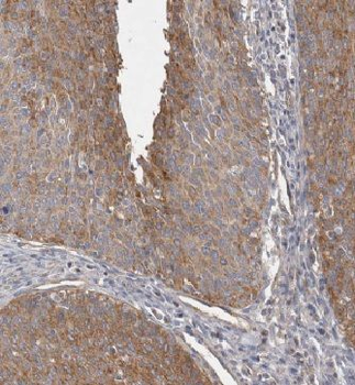 KIF22 Rabbit Polyclonal Antibody
