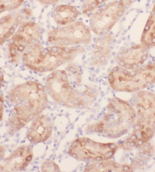 KIF26B Rabbit Polyclonal Antibody