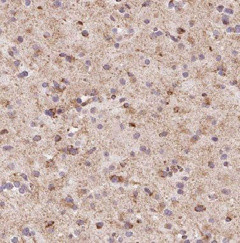 KIF3A Rabbit Polyclonal Antibody