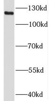 KIF5A Rabbit Polyclonal Antibody