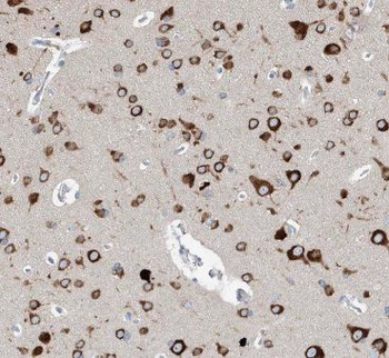KIF5A Rabbit Polyclonal Antibody