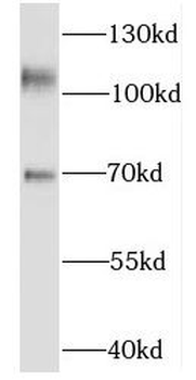 KIF5C Rabbit Polyclonal Antibody