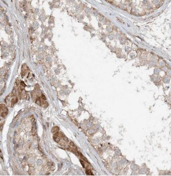 KIF5C Rabbit Polyclonal Antibody