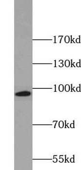 KIF6 Rabbit Polyclonal Antibody