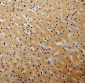 KIF6 Rabbit Polyclonal Antibody