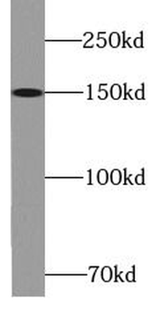 KIF7 Rabbit Polyclonal Antibody