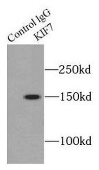 KIF7 Rabbit Polyclonal Antibody