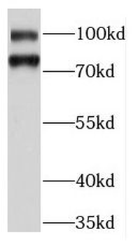 KIFC3 Rabbit Polyclonal Antibody