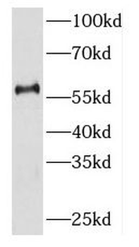 KIR2DL3 Rabbit Polyclonal Antibody