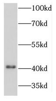 KCNJ10 Rabbit Polyclonal Antibody