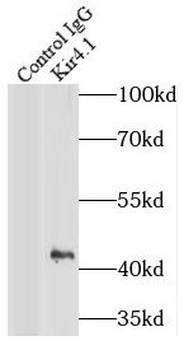 KCNJ10 Rabbit Polyclonal Antibody