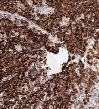 KCNJ10 Rabbit Polyclonal Antibody