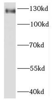 KIRREL3 Rabbit Polyclonal Antibody