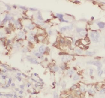 KISS1 Rabbit Polyclonal Antibody