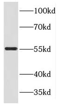KLC3 Rabbit Polyclonal Antibody