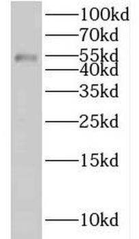 KLHDC3 Rabbit Polyclonal Antibody