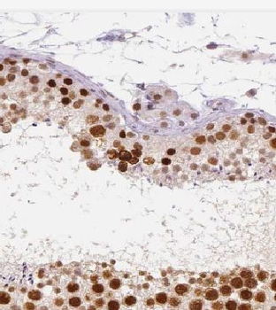 KLHDC3 Rabbit Polyclonal Antibody