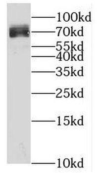 KLHL10 Rabbit Polyclonal Antibody