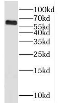 KLHL18 Rabbit Polyclonal Antibody