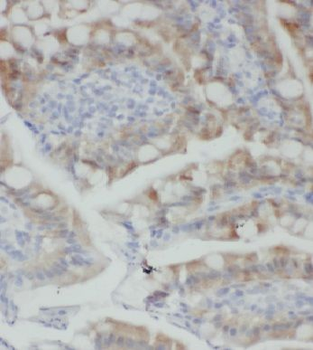 KLHL18 Rabbit Polyclonal Antibody