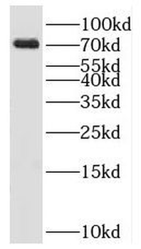 KLHL22 Rabbit Polyclonal Antibody