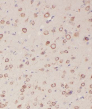 KLHL4 Antibody