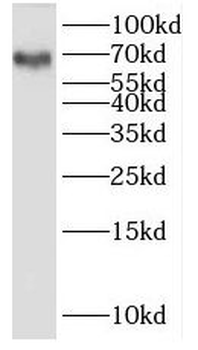 KLRF1 Rabbit Polyclonal Antibody