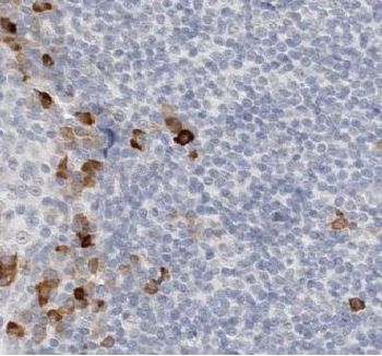 KLRF1 Rabbit Polyclonal Antibody
