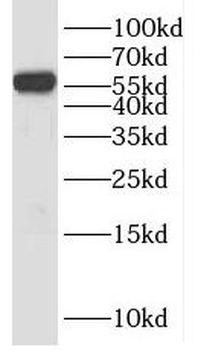 KLRG1 Rabbit Polyclonal Antibody