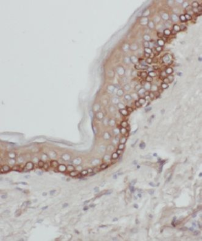 KLRG1 Rabbit Polyclonal Antibody