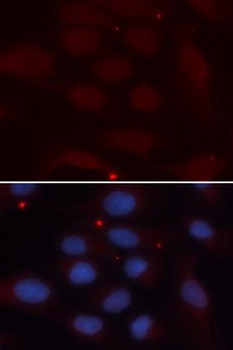KPNA1 Rabbit Polyclonal Antibody