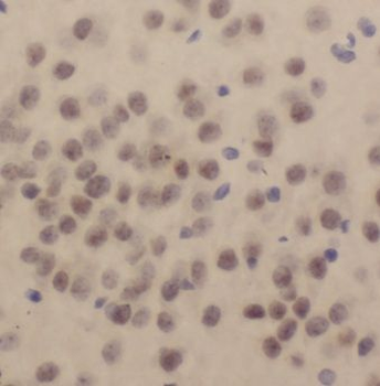 KPNA1 Rabbit Polyclonal Antibody