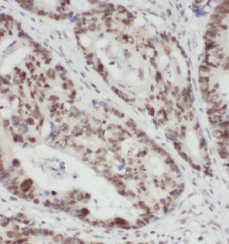 KPNA2 Rabbit Polyclonal Antibody