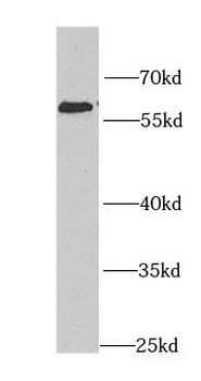 KPNA4 Rabbit Polyclonal Antibody
