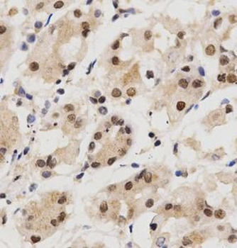 KPNA4 Rabbit Polyclonal Antibody