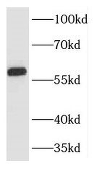 KPNA5 Rabbit Polyclonal Antibody