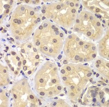 KPNA6 Rabbit Polyclonal Antibody